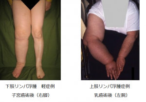 image_ex